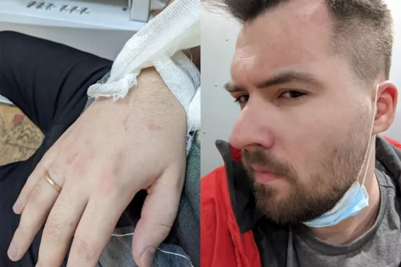 Затриманому Максиму Андрєєнкову пошкодили зв'язки правого ліктьового суглоба. За його словами, йому при затриманні сильно викручували руки, били по животу і ребрах, наступивши коліном на обличчя. 24 лютого 2022 року / Фото Максим Андрєєнков
