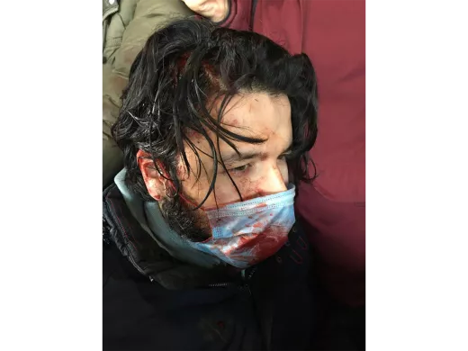 Shukhrat Shiroliev a été frappé à la tête lors de son arrestation. Selon lui, il a été interpellé non loin du monument à Pierre le Grand à Saint-Pétersbourg, jeté à terre et battu à coups de matraque. 6 mars 2022 / Photo fournie par d'autres détenus