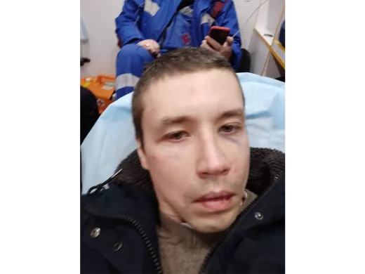 Anton Mishchenko, détenu à Moscou, a déclaré avoir été battu pour avoir filmé des policiers du département de police de Maryino. Selon les médecins ambulanciers, Mishchenko a une commotion cérébrale. 6 mars 2022 / Photo publiée avec l'aimable autorisation de Mishchenko