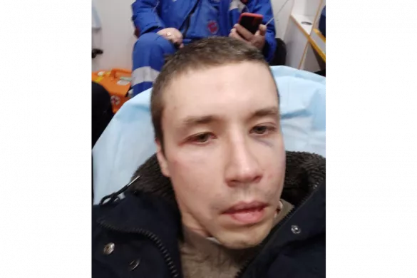 Затриманий у Москві Антон Міщенко розповів, що його побили за зйомку співробітників поліції біля відділку поліції Мар'їно. За словами лікарів швидкої, у Міщенка струс. 6 березня 2022 року / Фото надане Міщенком