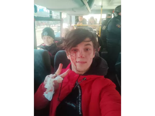 Vasily Tikhanov a été frappé à la tête lors de son arrestation à Saint-Pétersbourg. 6 mars 2022 / Photo fournie par Tikhanov
