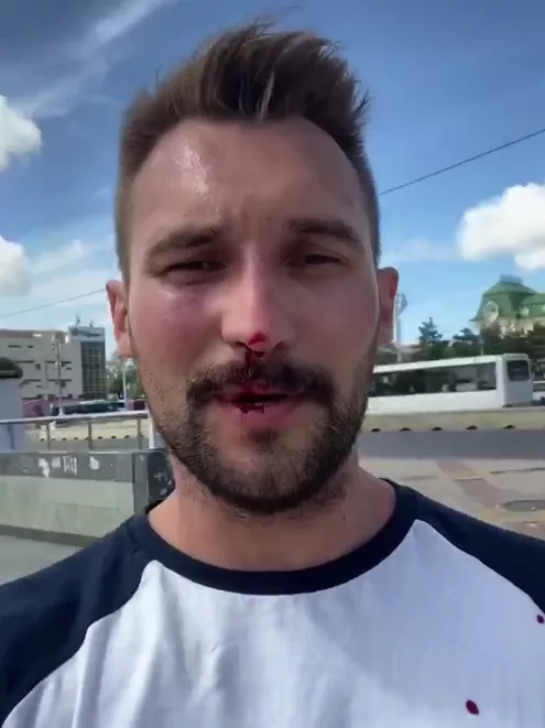Сергей Наумов после избиения / Кадр из видео видео Татьяны Усмановой